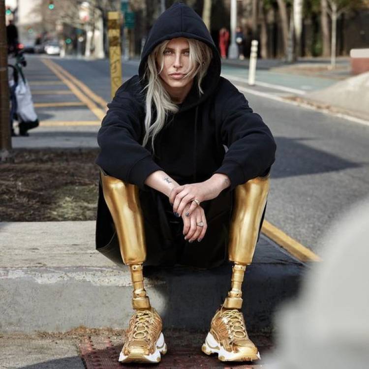 Prišla o obe nohy kvôli tampónu! Poznáte príbeh modelky Lauren Wasser?