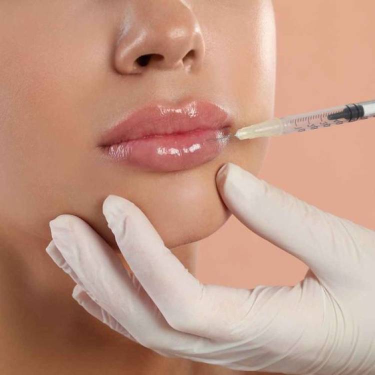Lip Filler: Všetko, čo potrebujete vedieť o zväčšení pier kyselinou hyalurónovou