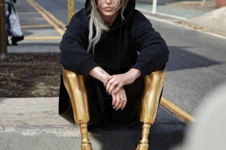 Prišla o obe nohy kvôli tampónu! Poznáte príbeh modelky Lauren Wasser?
