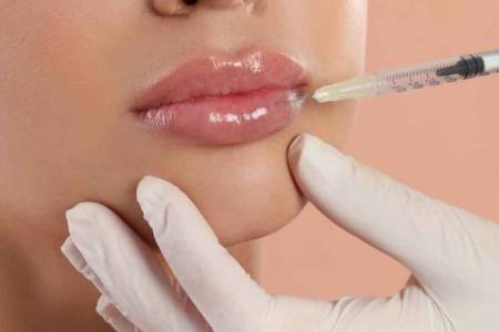 Lip Filler: Všetko, čo potrebujete vedieť o zväčšení pier kyselinou hyalurónovou
